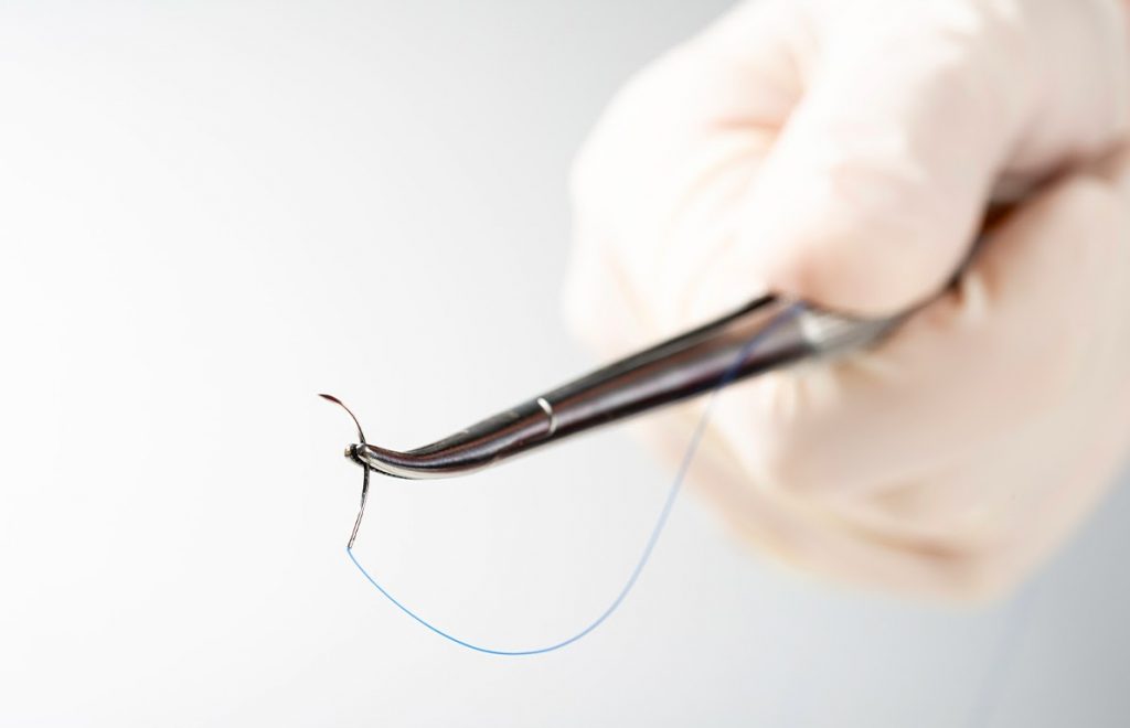 types-de-sutures-en-chirurgie-esthetique